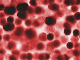 Blood cells on a slide.